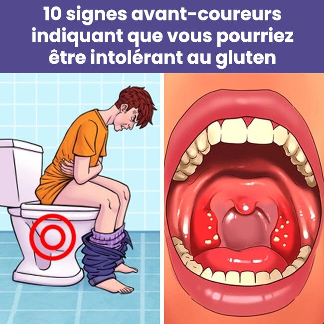 10 signes avant-coureurs indiquant que vous pourriez être intolérant au gluten