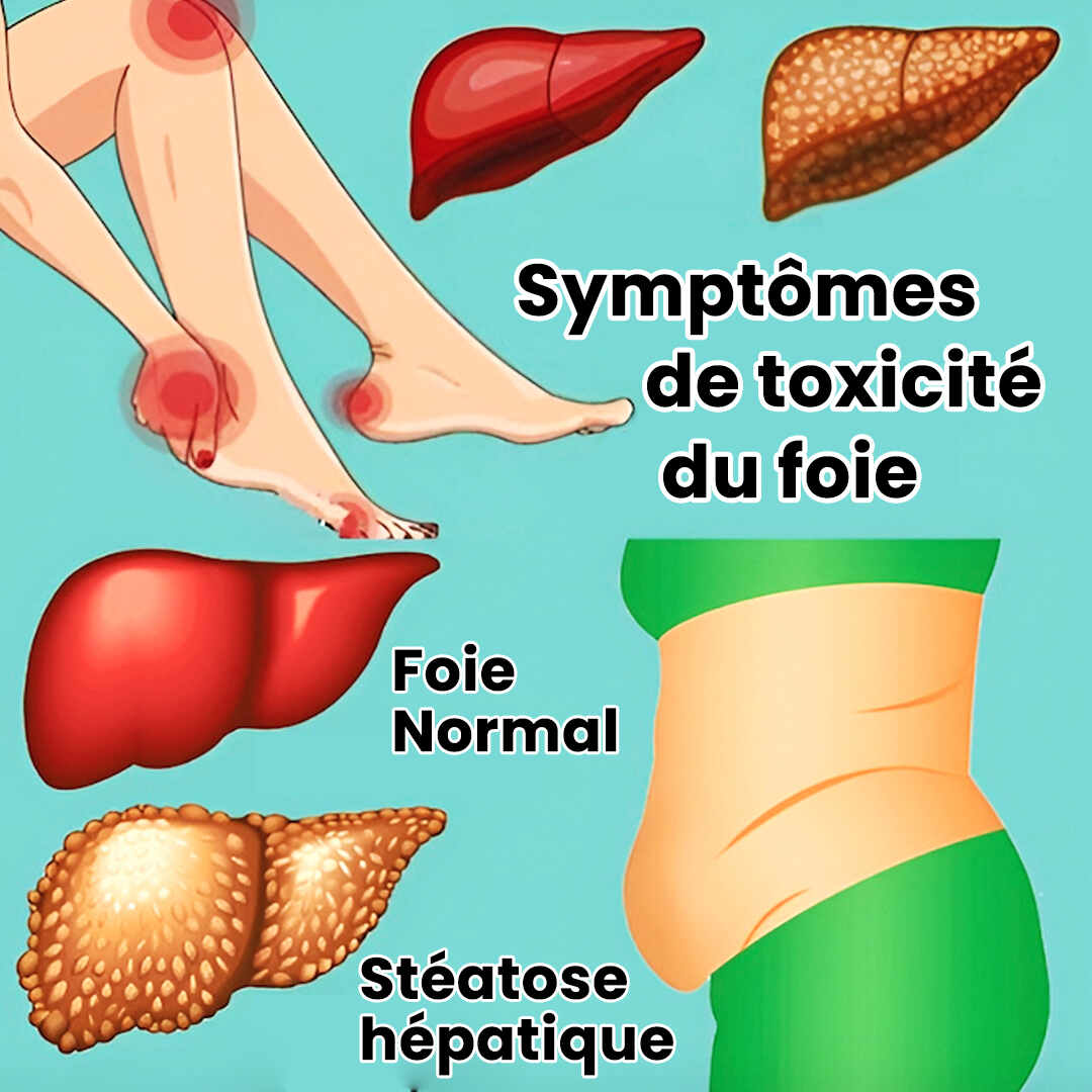 11 indices indiquant un dysfonctionnement du foie et une accumulation de toxines dans votre organisme