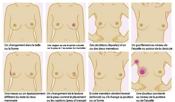 5-types-courants-de-cancer-et-leurs-symptômes-que-vous-devez-connaitre1