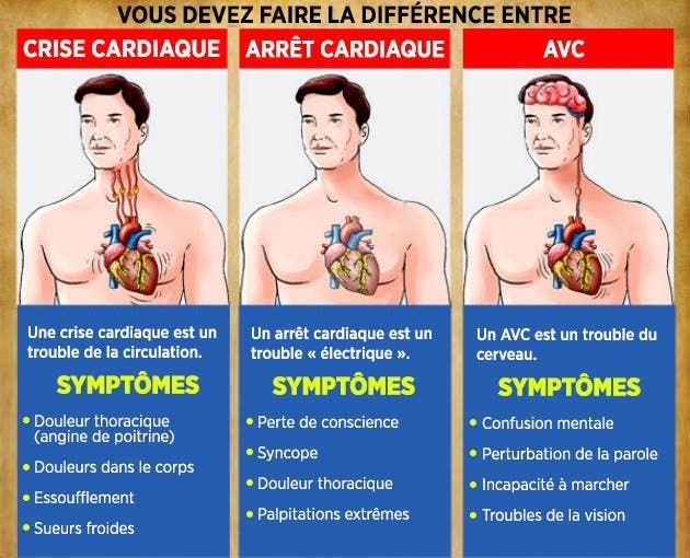 AVC