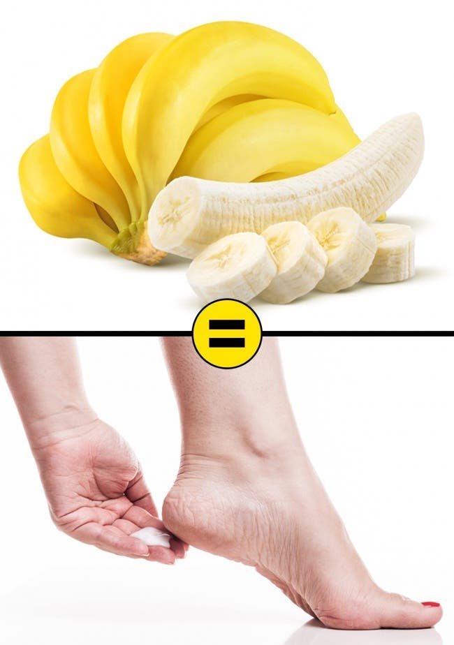 Banane