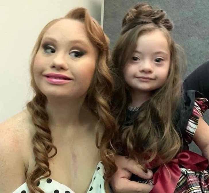 Francesca Rausi et Madeline Stuart