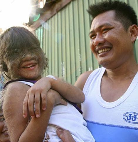 La fille la plus poilue du monde décide de se rase le visage