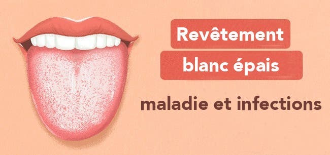 Les 13 choses que votre langue essaye de vous dire au sujet de votre santé