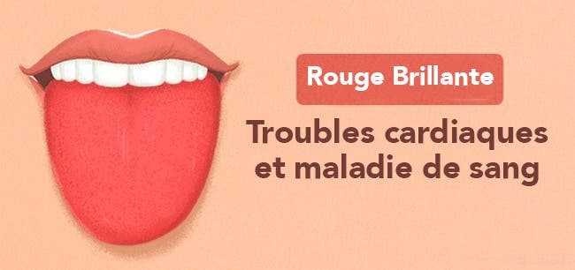 Les 13 choses que votre langue essaye de vous dire au sujet de votre santé