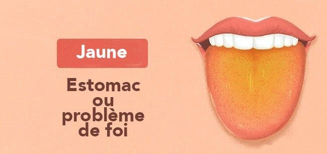 Les 13 choses que votre langue essaye de vous dire au sujet de votre santé