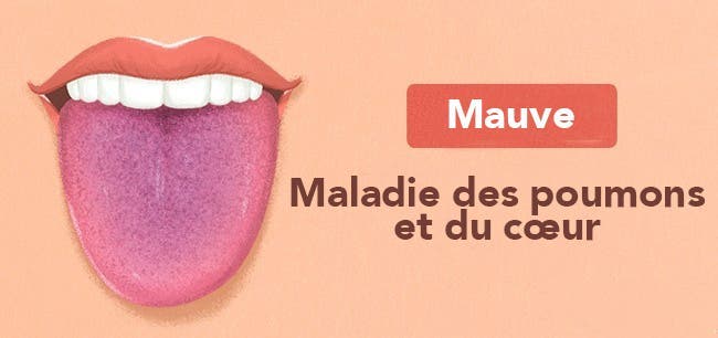 Les 13 choses que votre langue essaye de vous dire au sujet de votre santé