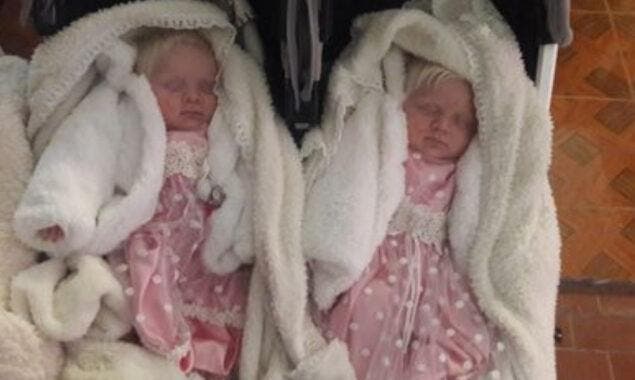 Les deux bébés albinos