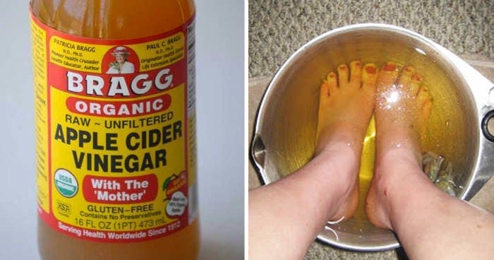 Mettez vos pieds 15 minutes dans du vinaigre