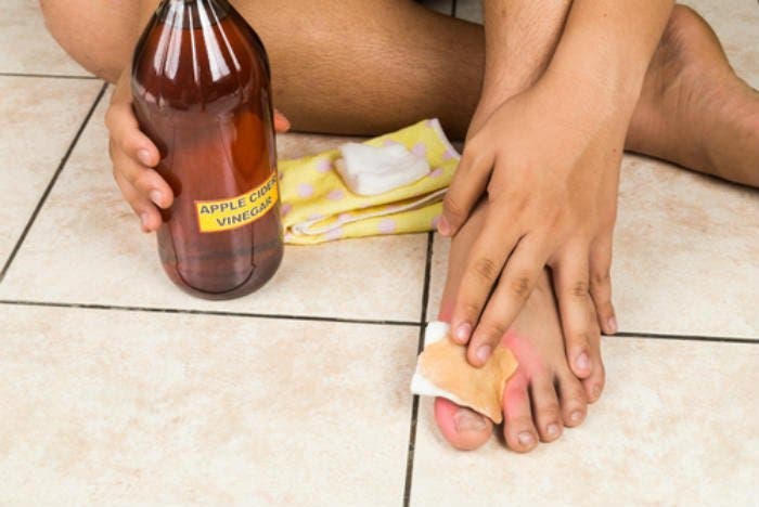 Mettez vos pieds 15 minutes dans du vinaigre