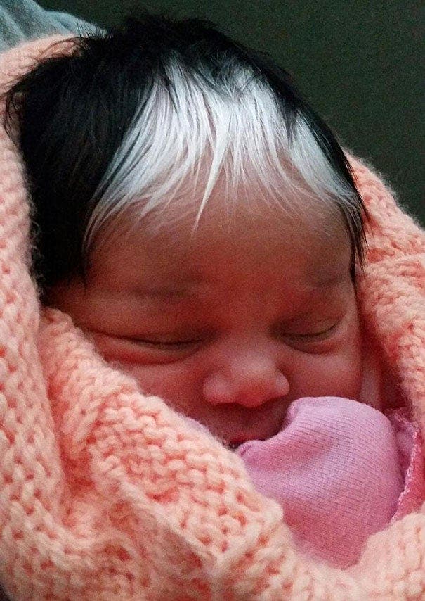 Un bébé est né avec des cheveux blancs