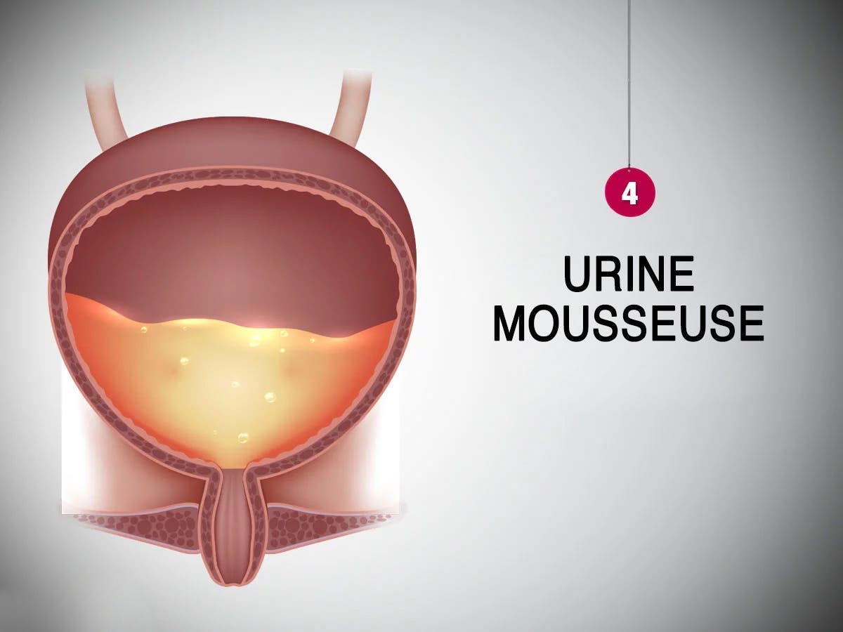 Une urine mousseuse