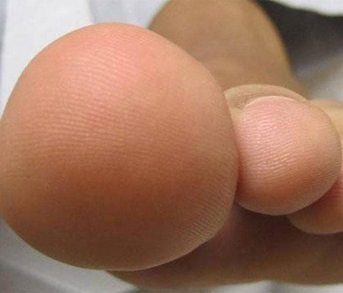 Vos pieds révèlent beaucoup de choses sur votre personnalité