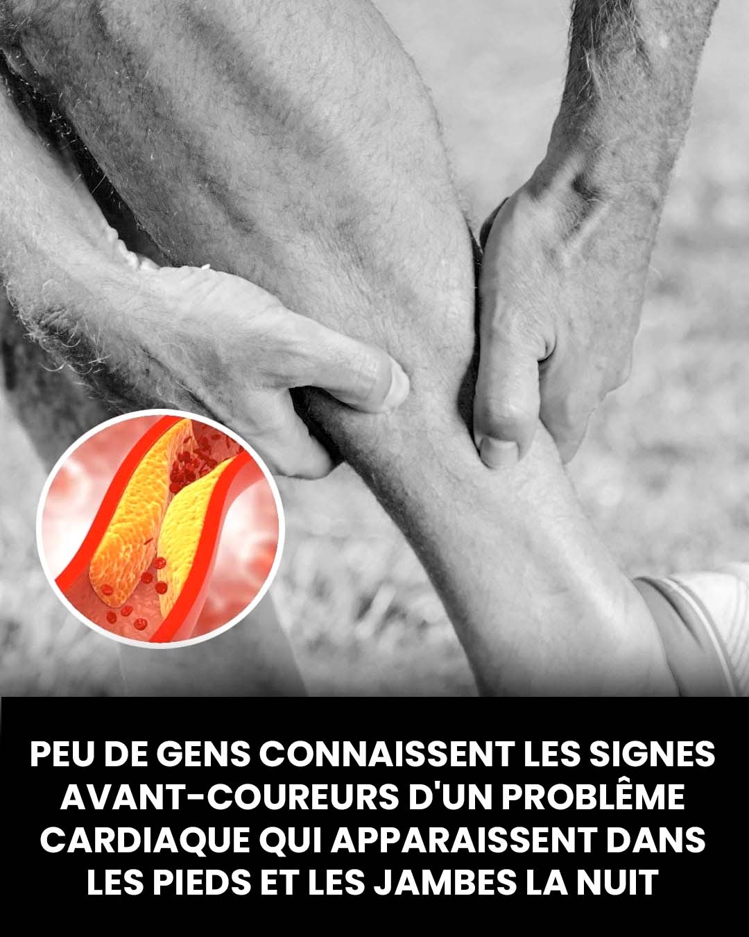 Ce que vos pieds peuvent révéler sur les problèmes cardiaques