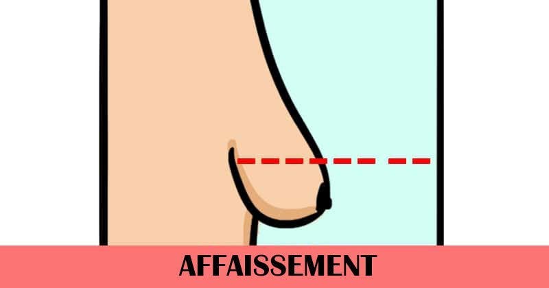 6 changements que subissent vos seins avec l’âge