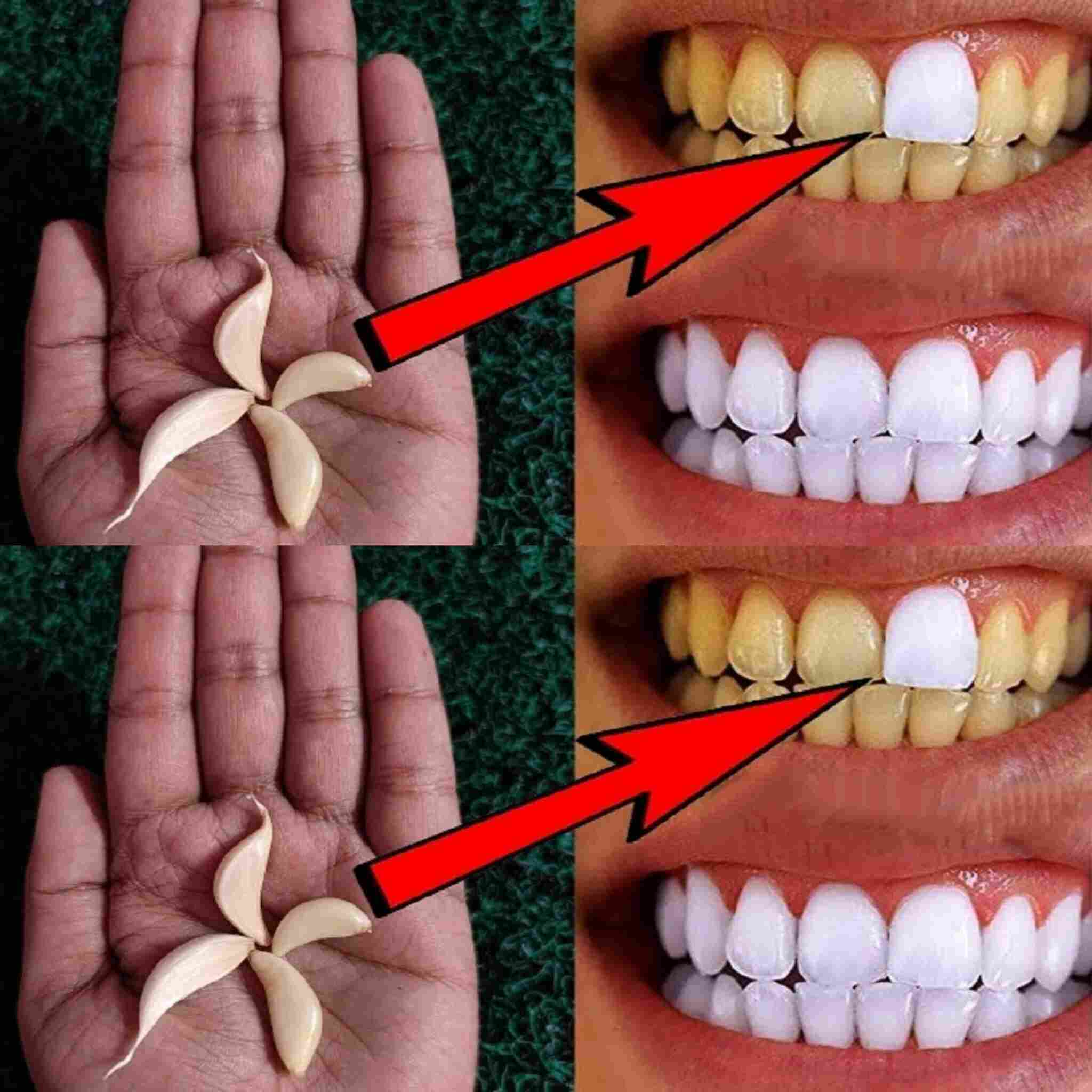 Comment blanchir les dents avec de l’ail ?