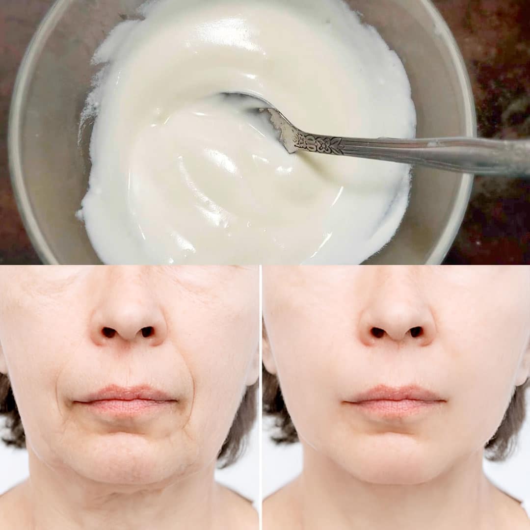 Crème au bicarbonate de soude pour le visage : éliminer les rides et taches avec ce remède