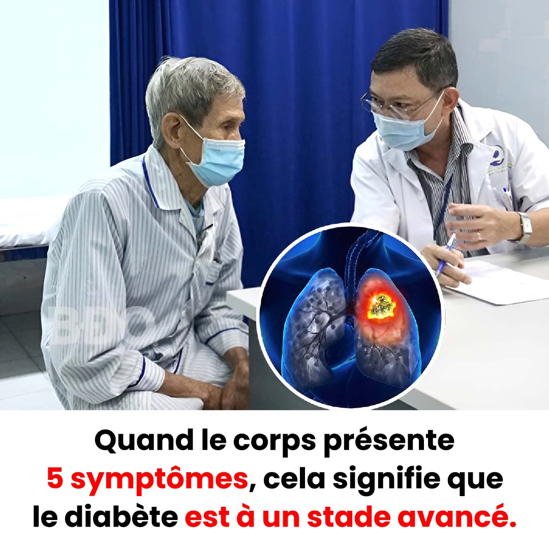 Quand le corps présente 5 symptômes, cela signifie que le diabète est à un stade avancé