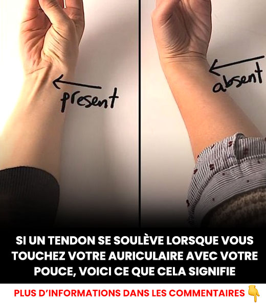 Si un tendon se soulève lorsque vous touchez votre auriculaire avec votre pouce, voici ce que cela signifie