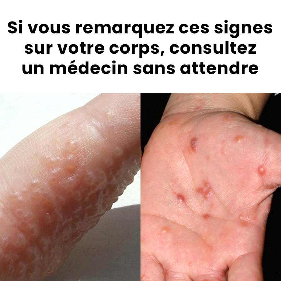 Si vous remarquez ces signes sur votre corps, consultez rapidement