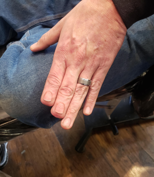 Un tatoueur restaure des ongles sur un homme qui a perdu deux doigts