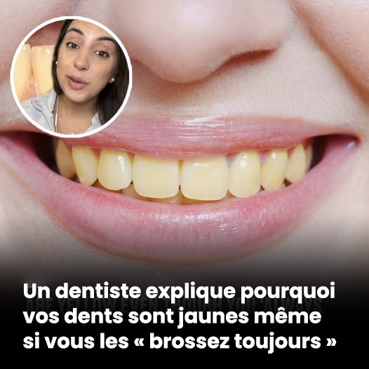 Un dentiste explique pourquoi vos dents sont jaunes même si vous les « brossez toujours »