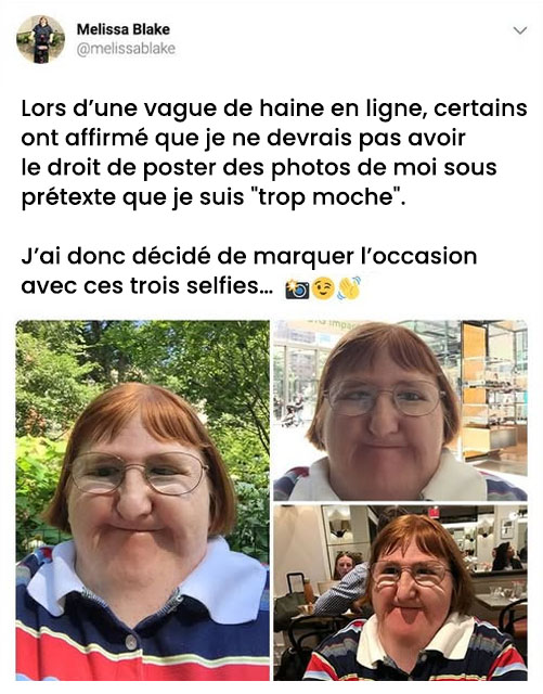 Une femme victime de harcèlement prend des selfies pour donner une belle leçon à ses détracteurs