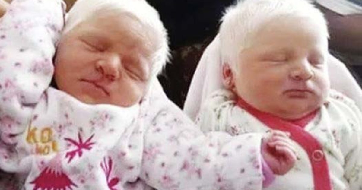 Une maman donne naissance à des jumeaux albinos rares aux cheveux blancs comme neige