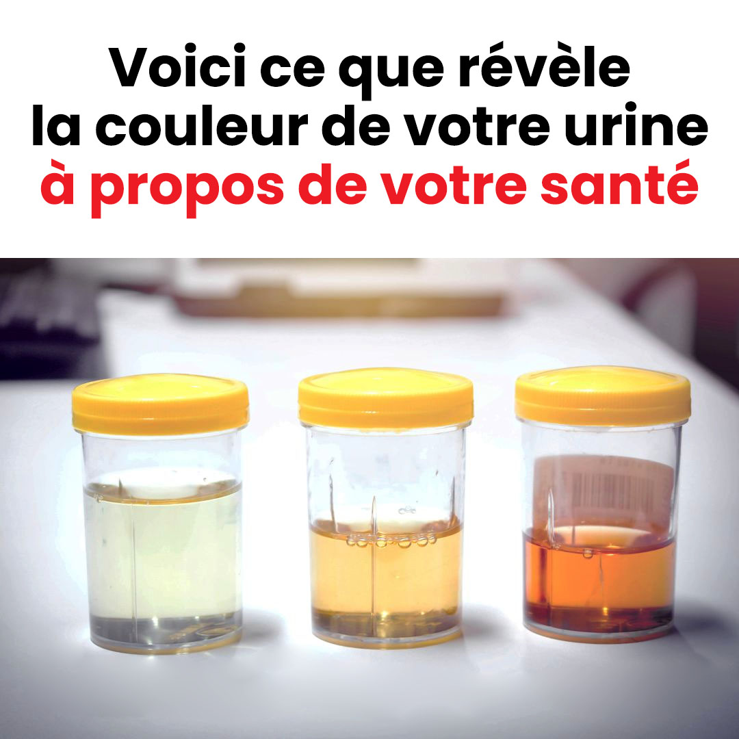 Voici ce que révèle la couleur de votre urine à propos de votre santé